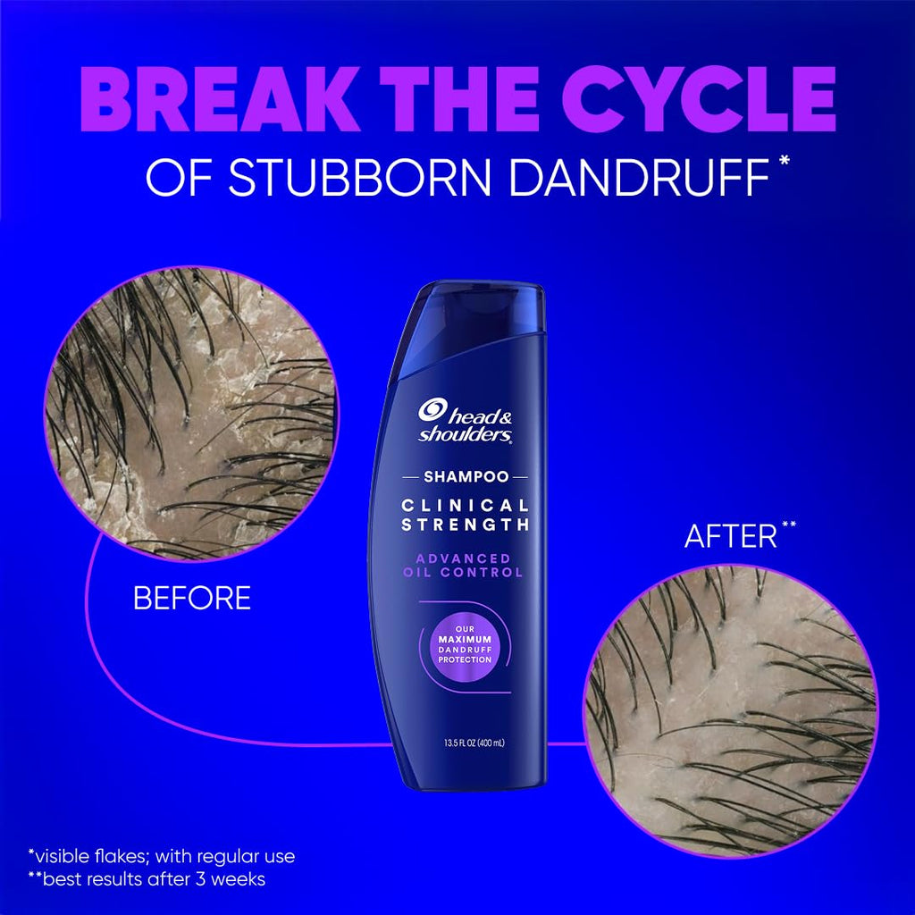 Head & Shoulders Clinical Strength Advanced Oil Control Anti-Dandruff Shampoo, 1% Selenium Sulfide, Stubborn Dandruff, 13.5 fl oz