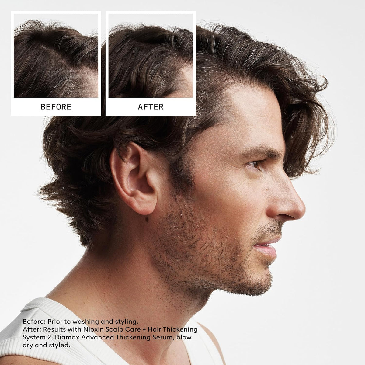 NIOXIN System 2 | Scalp Care | Shampoo | Hair Thickening | For Natural Hair